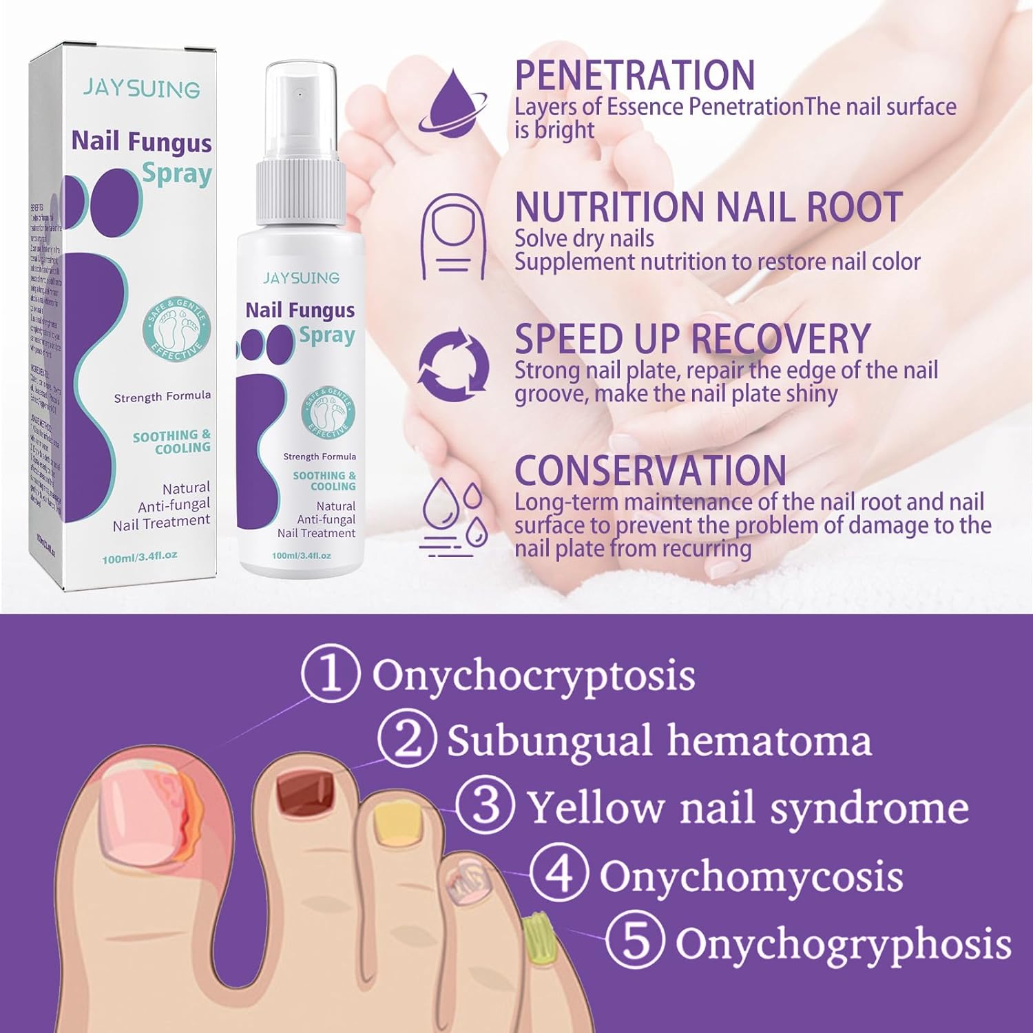 Nail Fungus Spray